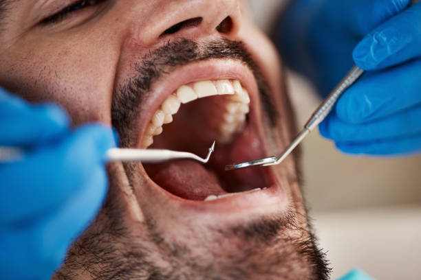 Best Emergency Dentist for Knocked-Out Tooth in Cambridge, MD
