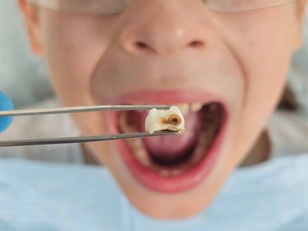Best Emergency Dental Services for Seniors in Cambridge, MD