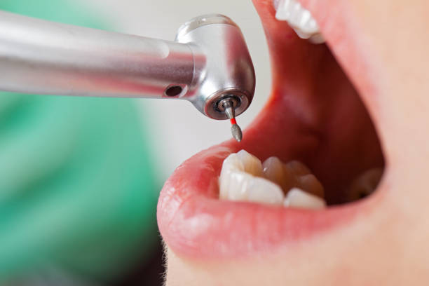 Best Pediatric Emergency Dentist in Cambridge, MD